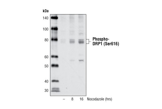 Western blot analysis of extracts from HeLa cells, untreated or nocodazole-treated for the indicated times, using Phospho-DRP1 (Ser616) Antibody.