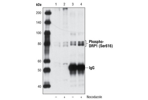 Immunoprecipitation of Phospho-DRP1 (Ser616) from HeLa cell extracts, untreated or nocodazole-treated, using Phospho-DRP1 (Ser616) Antibody followed by western blot using the same antibody. Lanes 1 & 2 are 5% input.