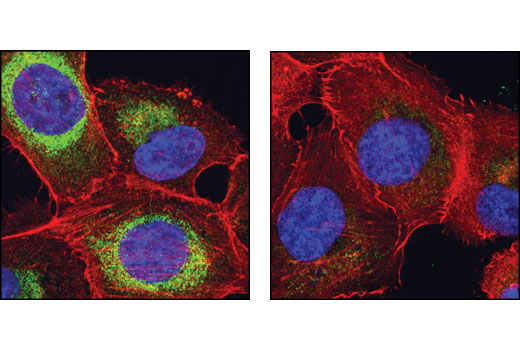 Confocal immunofluorescent analysis of NCI-H1299 cells, untreated (left) or λ-phosphatase-treated (right), using Phospho-DRP1 (Ser616) Antibody (green). Actin filaments have been labeled with DY-554 phallodin (red). Blue pseudocolor = DRAQ5 ® (fluorescent DNA dye).