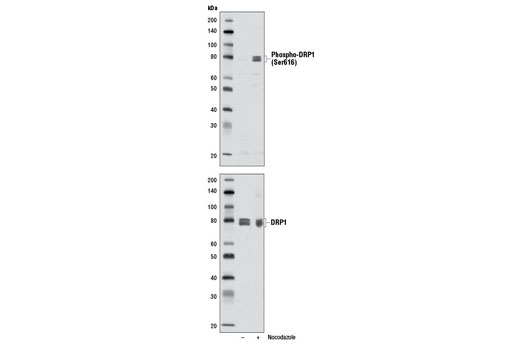 Western blot analysis of extracts from HeLa cells, untreated (-) or treated (+) with nocodazole (100 ng/ml, 17 hr), using Phospho-DRP1 (Ser616) (D9A1) Rabbit mAb (upper) and DRP1 (D6C7) Rabbit mAb #8570 (lower).