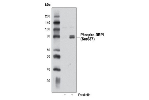 Western blot analysis of extracts from PC-12 cells, untreated or treated with Forskolin #3828 (20 μM, 1 hr), using Phospho-DRP1 (Ser637) (D3A4) Rabbit mAb.