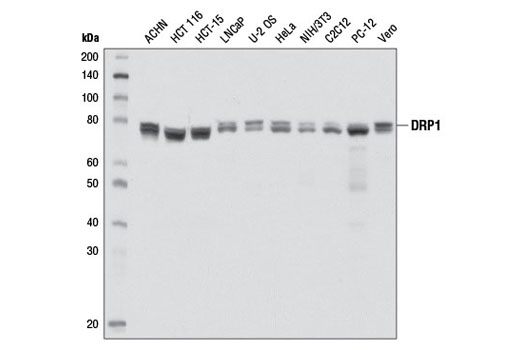Western blot analysis of extracts from various cell lines using DRP1 (D6C7) Rabbit mAb.