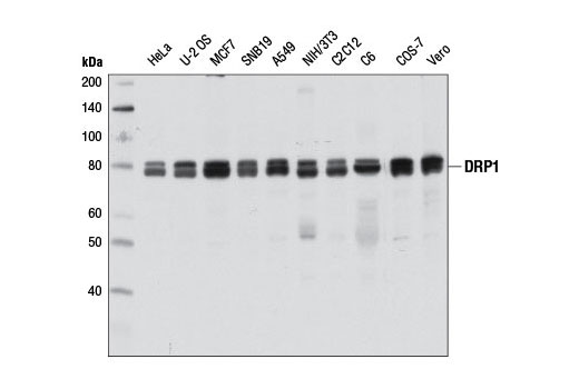 Western blot analysis of extracts from various cell lines using DRP1 (D8H5) Rabbit mAb.