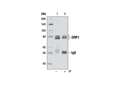 Immunoprecipitation of DRP1 from NIH/3T3 cell extracts using DRP1 (D8H5) Rabbit mAb (lane 2). Western blot detection was performed using the same antibody. Lane 1 is 10% input.