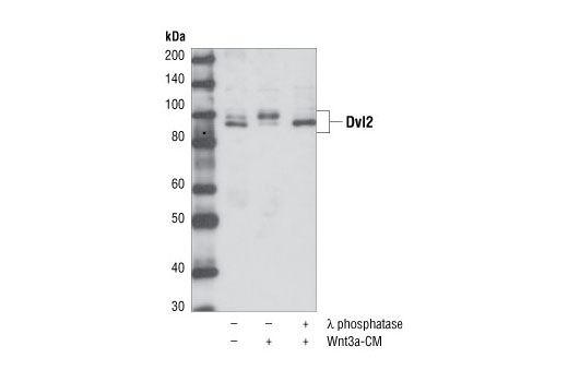 Western blot analysis of total cell extracts from NIH/3T3 cells, untreated or treated with conditioned medium containing Wnt3a for 3 hours and also treated with or without lambda phosphatase, using Dvl2 Antibody.