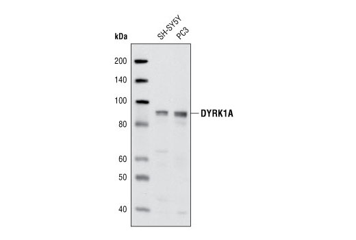 Western blot analysis of extracts from SY-SY5Y and PC3 cells using DYRK1A Antibody.