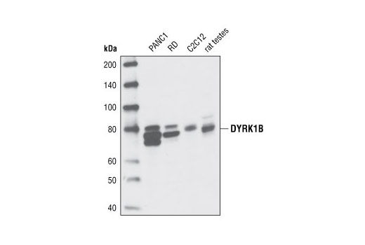 Western blot analysis of extracts from various cell lines and rat testes using DYRK1B Antibody.