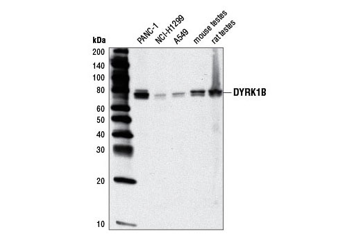 Western blot analysis of extracts from various cell lines and tissues using DYRK1B (D40D1) Rabbit mAb.