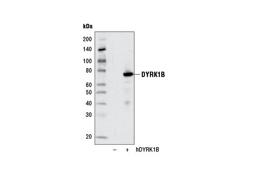 Western blot analysis of extracts from 293T cells, mock transfected (-) or transfected with a human DYRK1B contstruct (+), using DYRK1B (D40D1) Rabbit mAb.