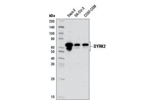 Western blot analysis of extracts from various cell lines using DYRK2 Antibody.