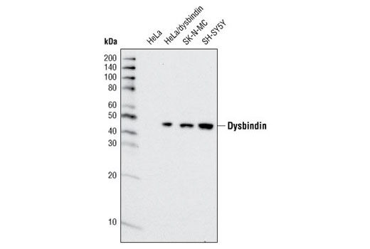 Western blot analysis of HeLa cells, untransfected or transfected with a construct overexpressing dysbindin, and other cell lines using Dysbindin Antibody.
