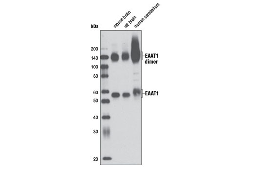 Western blot analysis of extracts of tissue from mouse brain, rat brain, and human cerebellum using EAAT1 (D44E2) XP ® Rabbit mAb.