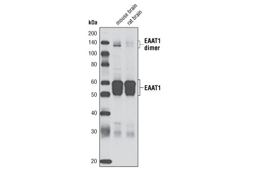 Western blot analysis of extracts from mouse and rat brain using EAAT1 (D20D5) Rabbit mAb.