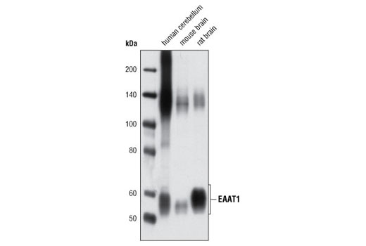 Western blot analysis of extracts from human cerebellum, mouse and rat brain using EAAT1 Antibody.