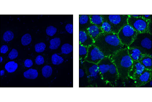 Confocal immunofluorescent analysis of A431 cells serum-starved (left) or EGF-treated (right) and labeled with Phospho-EGF Receptor (Tyr1045) Antibody (green). Blue pseudocolor = DRAQ5™ (fluorescent DNA dye).