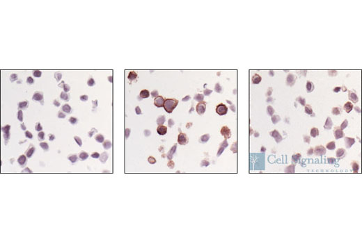 Immunohistochemical annalysis of paraffin-embedded MDA-MB-468 cells, untreated (left), EGF treated (middle), or EGF and Tarceva® treated (right), using Phospho-EGF Receptor (Tyr1068) Antibody.