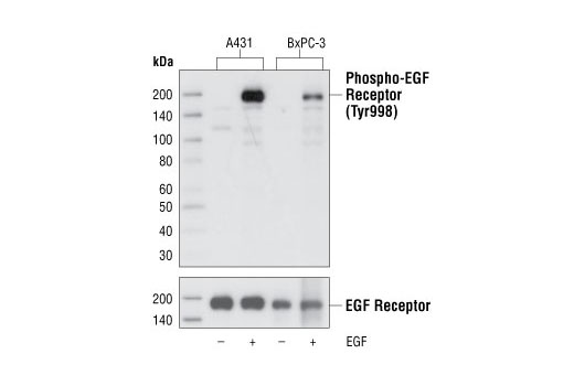 Western blot analysis of extracts from A431 and BxPC-3 cells, untreated or treated with EGF, using Phospho-EGF Receptor (Tyr998) (C24A5) Rabbit mAb (upper) and EGF Receptor Antibody #2232 (lower).
