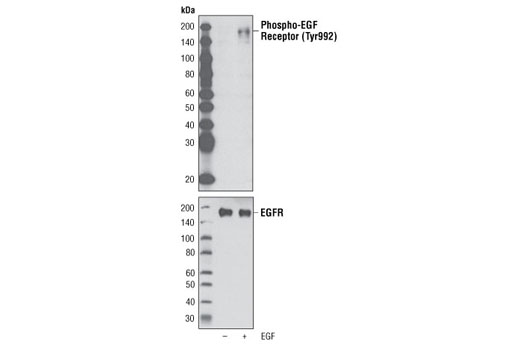 Western blot analysis of extracts from A431 cells, untreated or EGF-treated (100 ng/ml), using Phospho-EGF Receptor (Tyr992) Antibody (upper) or EGF Receptor Antibody #2232 (lower).