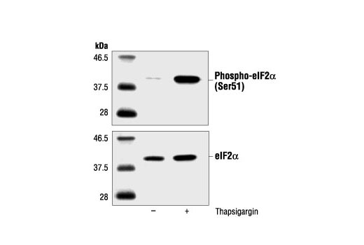 Western blot analysis of extracts from PC12 cells, untreated or thapsigargin-treated (300 nM), using Phospho-eIF2alpha (Ser51) Antibody (upper) or eIF2alpha Antibody #9722 (lower).