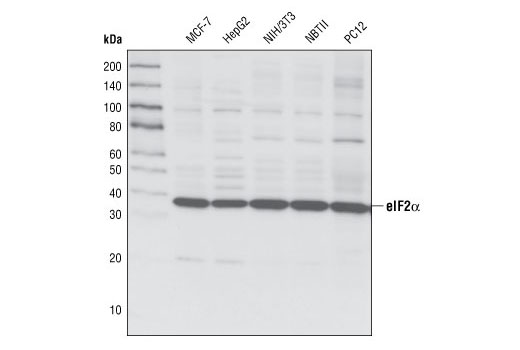 Western blot analysis of extracts from various cell types using eIF2α (L57A5) Mouse mAb.