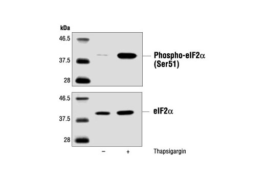 Western blot analysis of extracts from PC12 cells, untreated or thapsigargin-treated (300 nM) using Phospho-eIF2α (Ser51) Antibody #9721 (upper) and control eIF2α Antibody (lower).