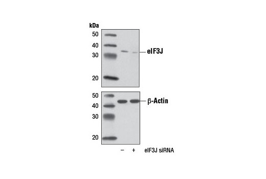 Western blot analysis of extracts from HeLa cells, mock transfected (-) or transfected with eIF3J-specific siRNA (+), using eIF3J (D21G7) XP ® Rabbit mAb.