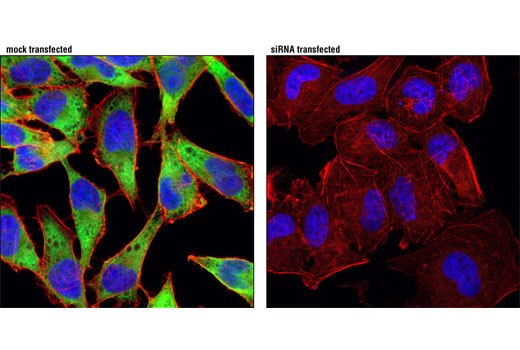 Confocal immunofluorescent analysis of HeLa cells, mock transfected or transfected with eIF3J-specific siRNA, using eIF3J (D21G7) XP ® Rabbit mAb (green). Actin filaments were labeled with DY-554 phalloidin (red). Blue pseudocolor = DRAQ5 ® #4084 (fluorescent DNA dye).