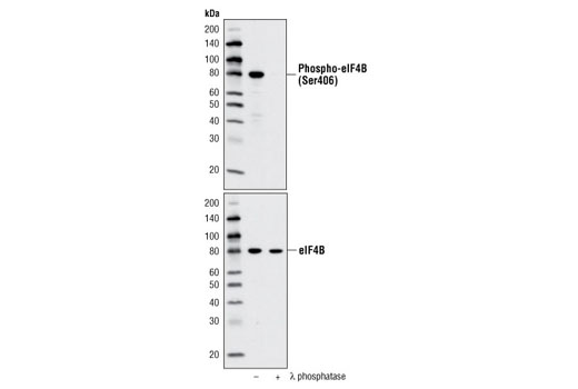 Western blot analysis of extracts from NIH/3T3 cells, untreated or λ phosphatase treated, using Phospho-eIF4B (Ser406) Antibody (upper) or eIF4B Antibody #3592 (lower).