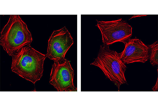 Confocal immunofluorescent analysis of HeLa cells, untreated (upper) or λ phosphatase treated (lower), using Phospho-eIF4B (Ser406) Antibody (green). Actin filaments were labeled with DY-554 phalloidin (red). Blue pseudocolor= DRAQ5® #4084 (fluorescent DNA dye).