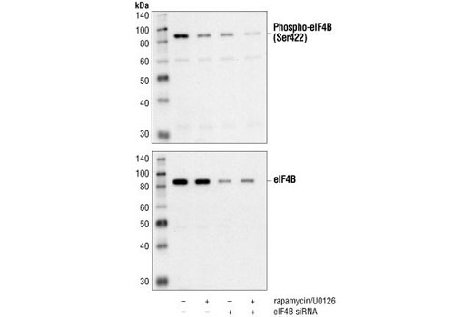 Western blot analysis of extracts from HeLa cells using Phospho-eIF4B (Ser422) Antibody (upper) or eIF4B Antibody #3592 (lower). 48 hours following siRNA transfection, cells were treated with Rapamycin (50 nM) and U0126 (10 µM) as indicated.