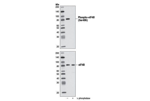 Western blot analysis of extracts from HeLa cells, untreated (-) or λ phosphatase-treated (+), using Phospho-eIF4B (Ser406) (D1C10) Rabbit mAb (upper) and eIF4B Antibody #3592 (lower).