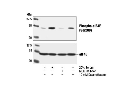 Western blot analysis of extracts from NIH/3T3 cells, untreated or treated with serum, PD98059 or Dexamethasone, using Phospho-eIF4E (Ser209) Antibody (upper) or eIF4E Antibody #9742 (lower).