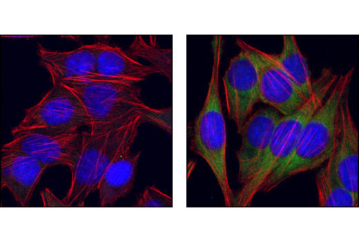 Confocal immunofluorescent analysis of HeLa cells either rapamycin-treated (left) or serum-treated (right), using Phospho-eIF4G (Ser1108) Antibody (green). Actin filaments have been labeled with Alexa Fluor® 555 phalloidin (red). Blue pseudocolor = DRAQ5™ (fluorescent DNA dye).