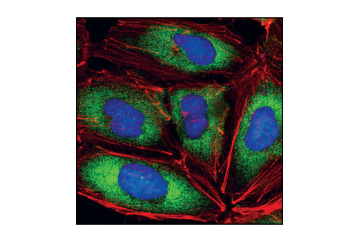 Confocal immunofluorescent analysis of HeLa cells using eIF4G (C45A4) Rabbit mAb (green). Actin filaments have been labeled with Alexa Fluor® 555 phalloidin (red). Blue pseudocolor = DRAQ5 ® #4084 (fluorescent DNA dye).