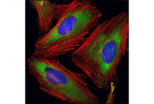 Confocal immunofluorescent analysis of HeLa cells using eIF4G2/p97 (D88B6) XP ® Rabbit mAb (green). Actin filaments have been labeled with DY-554 phalloidin (red). Blue pseudocolor = DRAQ5 ® #4084 (fluorescent DNA dye).