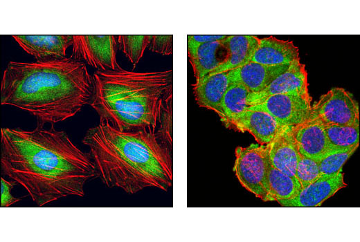Confocal immunofluorescent analysis of HeLa cells (left) and MCF-7 cells (right) using eIF4H (D85F2) XP ® Rabbit mAb (green). Actin filaments have been labeled with DY-554 phalloidin (red). Blue pseudocolor = DRAQ5 ® #4084 (fluorescent DNA dye).