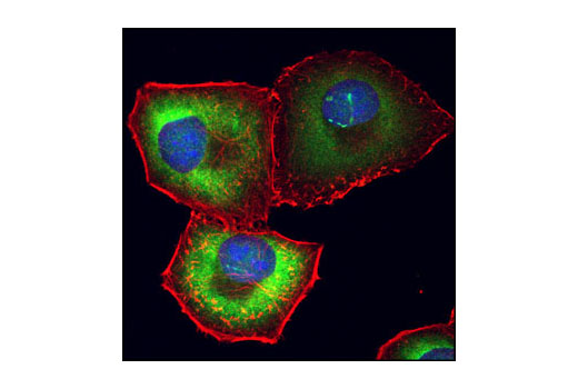 Confocal immunofluorescent analysis of PANC-1 cells using eIF4H Antibody (green). Actin filaments have been labeled with Alexa Fluor ® 555 phalloidin (red). Blue pseudocolor = DRAQ5 ® #4084 (fluorescent DNA dye).