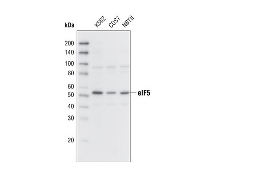 Western blot analysis of extracts from various cell lines using eIF5 Antibody.
