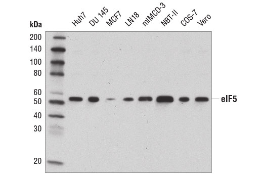 Western blot analysis of extracts from various cell lines using eIF5 (D5G9) Rabbit mAb.