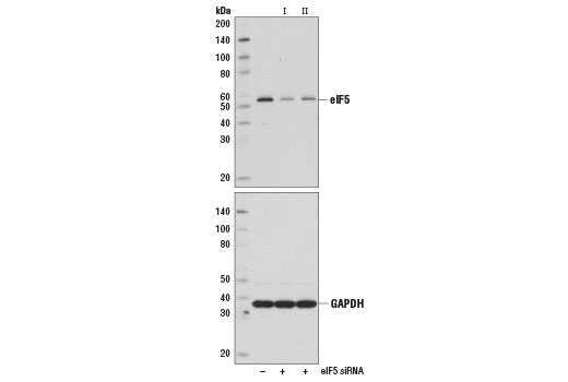 Western blot analysis of extracts from Huh7 cells, transfected with 100 nM SignalSilence ® Control siRNA (Unconjugated) #6568 (-), eIF5 siRNA I (+), or eIF5 siRNA II (+), using eIF5 (D5G9) Rabbit mAb (upper) and GAPDH (D16H11) XP ® Rabbit mAb #5174 (lower). The eIF5 (D5G9) Rabbit mAb confirms silencing of eIF5 expression, while the GAPDH (D16H11) XP ® Rabbit mAb is used as a loading control.