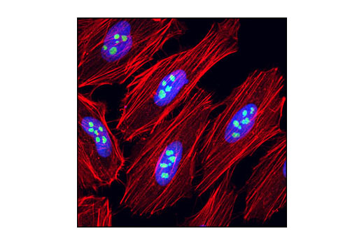 Confocal immunofluorescent analysis of HeLa cells using eIF6 (D16E9) XP ® Rabbit mAb (green). Actin filaments have been labeled with DY-554 phalloidin (red). Blue pseudocolor = DRAQ5 ® #4084 (fluorescent DNA dye).