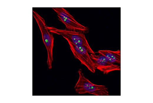 Confocal immunofluorescent analysis of HeLa cells using eIF6 Antibody (green). Actin filaments have been labeled with DY-554 phalloidin (red). Blue pseudocolor = DRAQ5 ® #4084 (fluorescent DNA dye).