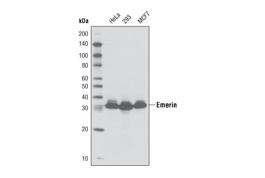 Western blot analysis of extracts from HeLa, 293, and MCF7 cell lines using Emerin (D9B3) Rabbit mAb.