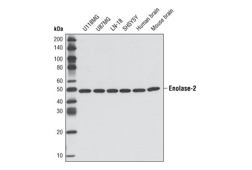 Western blot analysis of extracts from various cell lines and human and mouse brain using Enolase-2 Antibody.