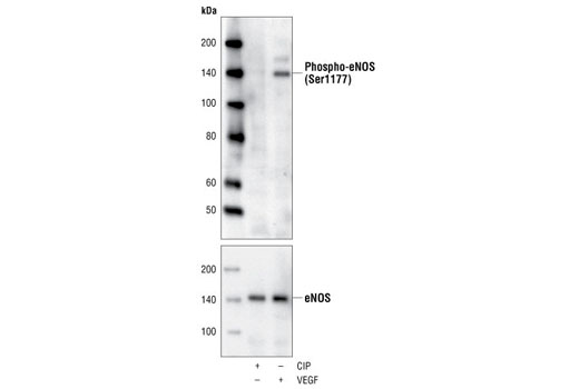 Western blot analysis of extracts from BAEC cells, phosphatase or VEGF-treated, using Phospho-eNOS (Ser1177) (C9C3) Rabbit mAb (upper) or eNOS Antibody #9572 (lower).