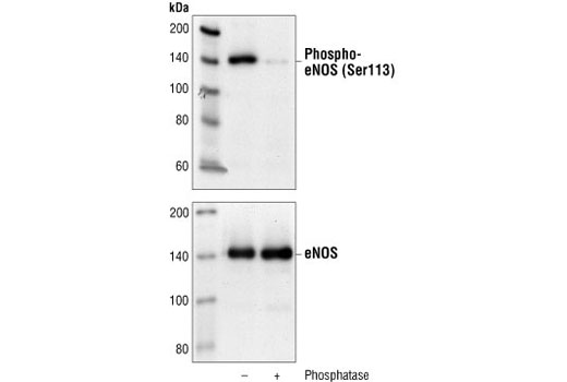 Western blot analysis of extracts from bovine aoric endothelial cells (BAEC), untreated or treated with lamda phosphatase, using Phospho-eNOS (Ser113) Antibody (upper) or eNOS antibody (lower).