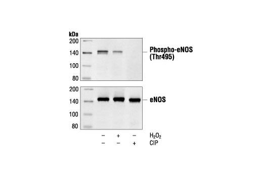 Western blot analysis of extracts from porcine aortic endothelial cells (PAECs), 3 days post-confluence, untreated, H2O2-treated (0.3 mM for 30 minutes) or calf intestinal alkaline phosphatase (CIP)-treated as indicated, using Phospho-eNOS (Thr495) Antibody (upper) or control eNOS antibody (lower).