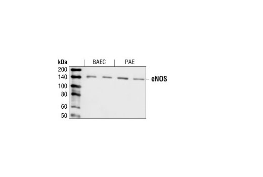 Western blot analysis of extracts from bovine aortic endothelial cells, untreated or VEGF-treated, and PAE cells, untreated or UV-treated, using eNOS Antibody.