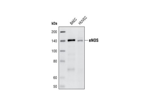 Western blot analysis of extracts from BAEC and HUVEC cells, using eNOS (49G3) Rabbit mAb.