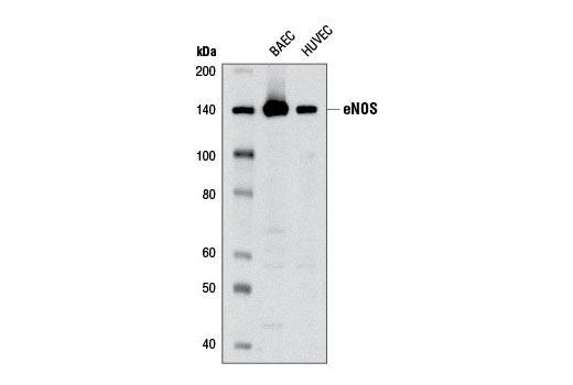Western blot analysis of extracts from BAEC and HUVEC cells using eNOS (6H2) Mouse mAb.